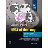 Elsevier Specialty Imaging: HRCT of the Lung
